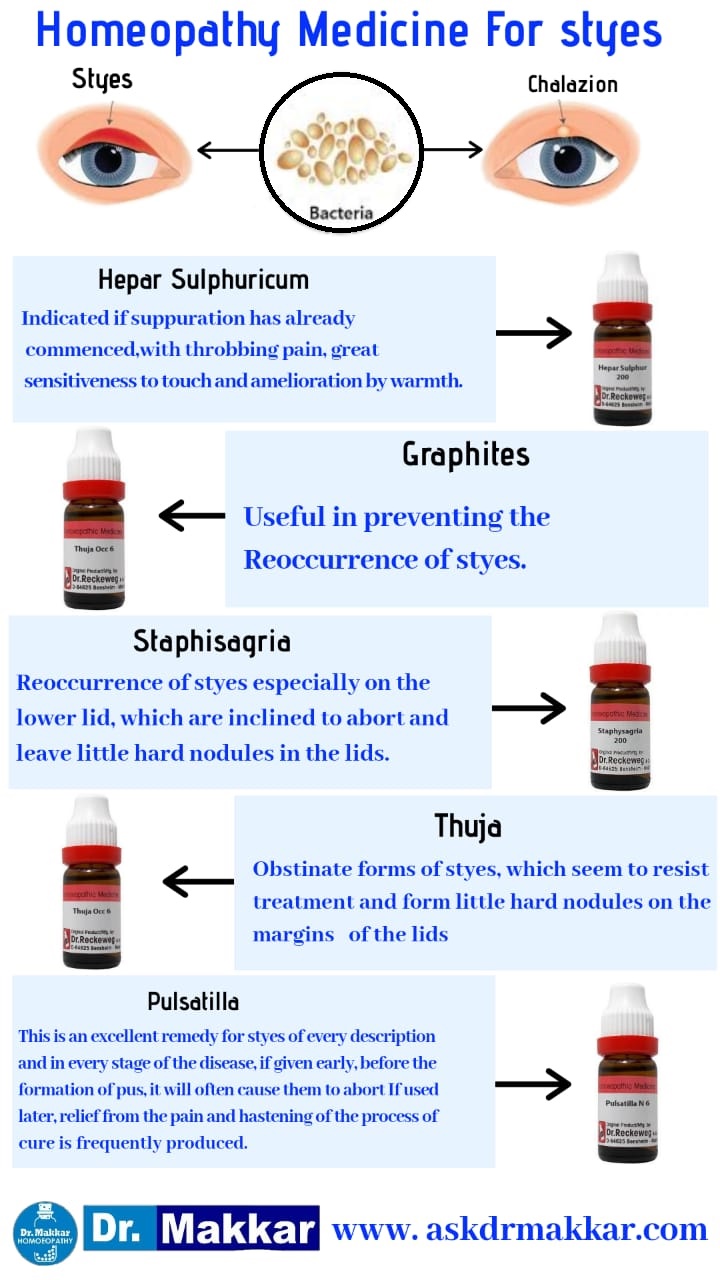 Stye vs Chalazion homeopathic treatment